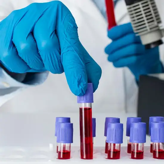 Blood Tests in Yamuna Vihar